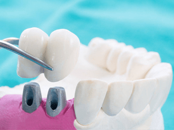 Protetika Dentaltime